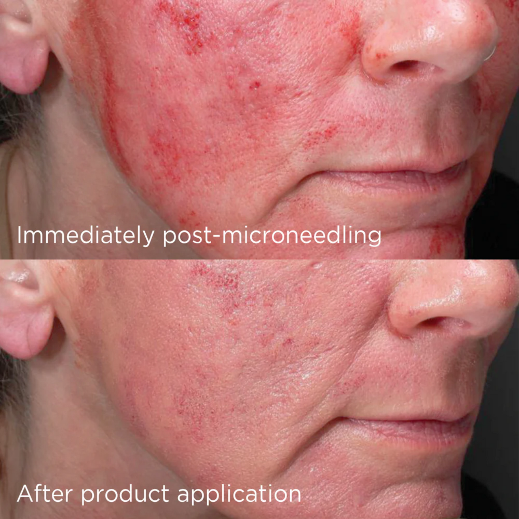 IMAGE DAILY PREVENTION Advanced Smartblend Mineral Moisturiser SPF 50+