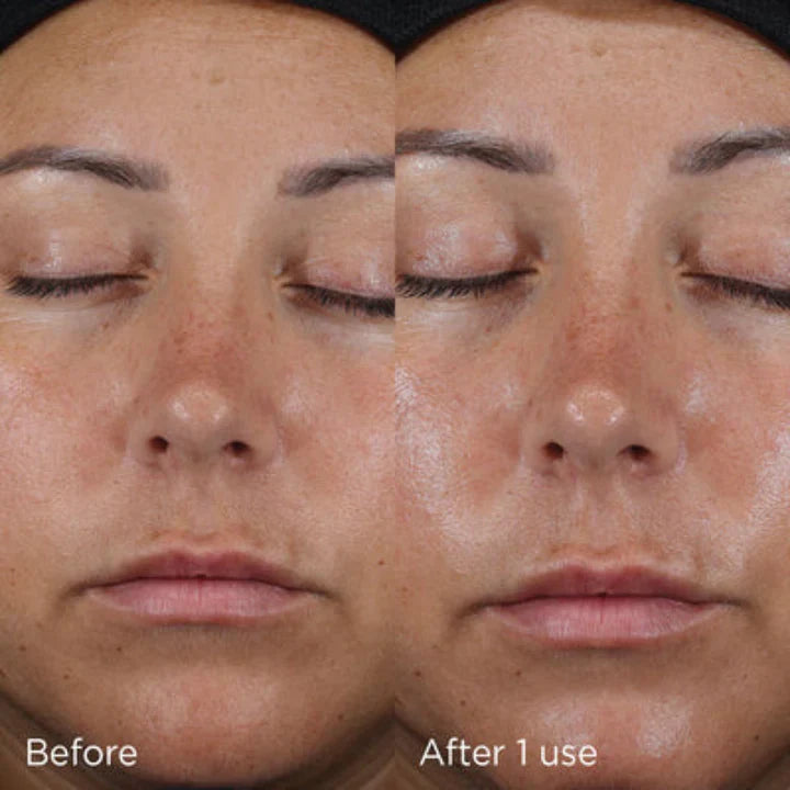 IMAGE Daily Prevention Ultra Defense Moisturizer SPF 50
