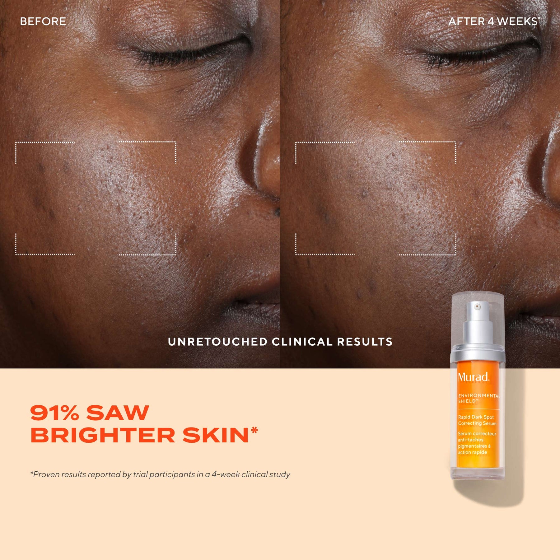 Murad Rapid Dark Spot Correcting Serum 30ml