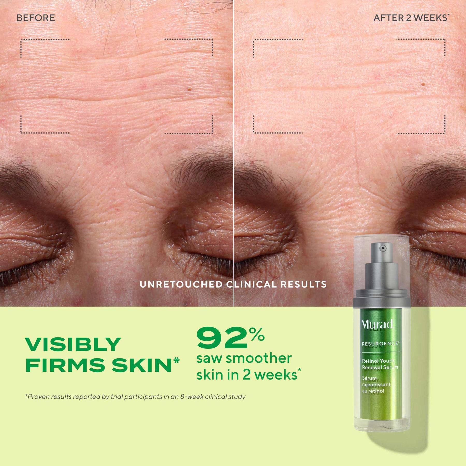 Murad Retinol Youth Renewal Serum 30ml