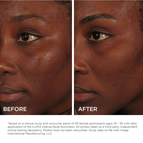 Image ILUMA Intense Facial illuminator 30ml