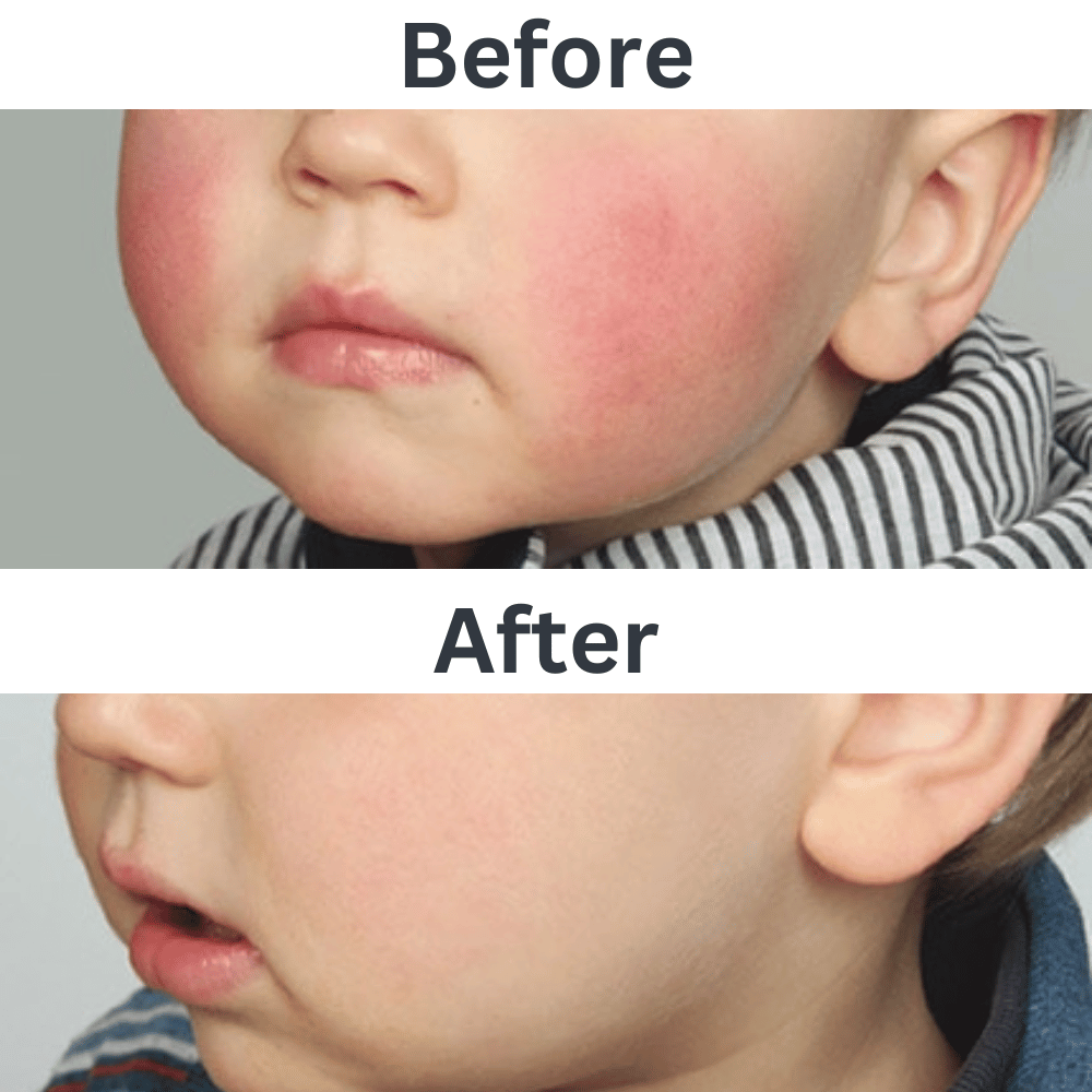 ISDIN Nutratopic Pro-Amp Facial Cream 50ml