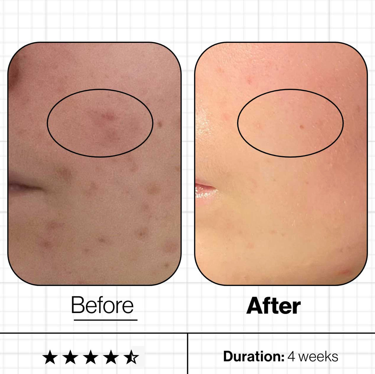 Advanced Nutrition Programme Skin Clear Biome (60 Capsules)