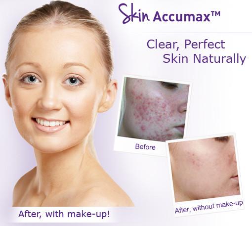 Advanced Nutrition Programme Skin Accumax (120 Capsules)