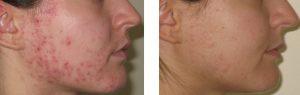 Advanced Nutrition Programme Skin Accumax (180 Capsules)