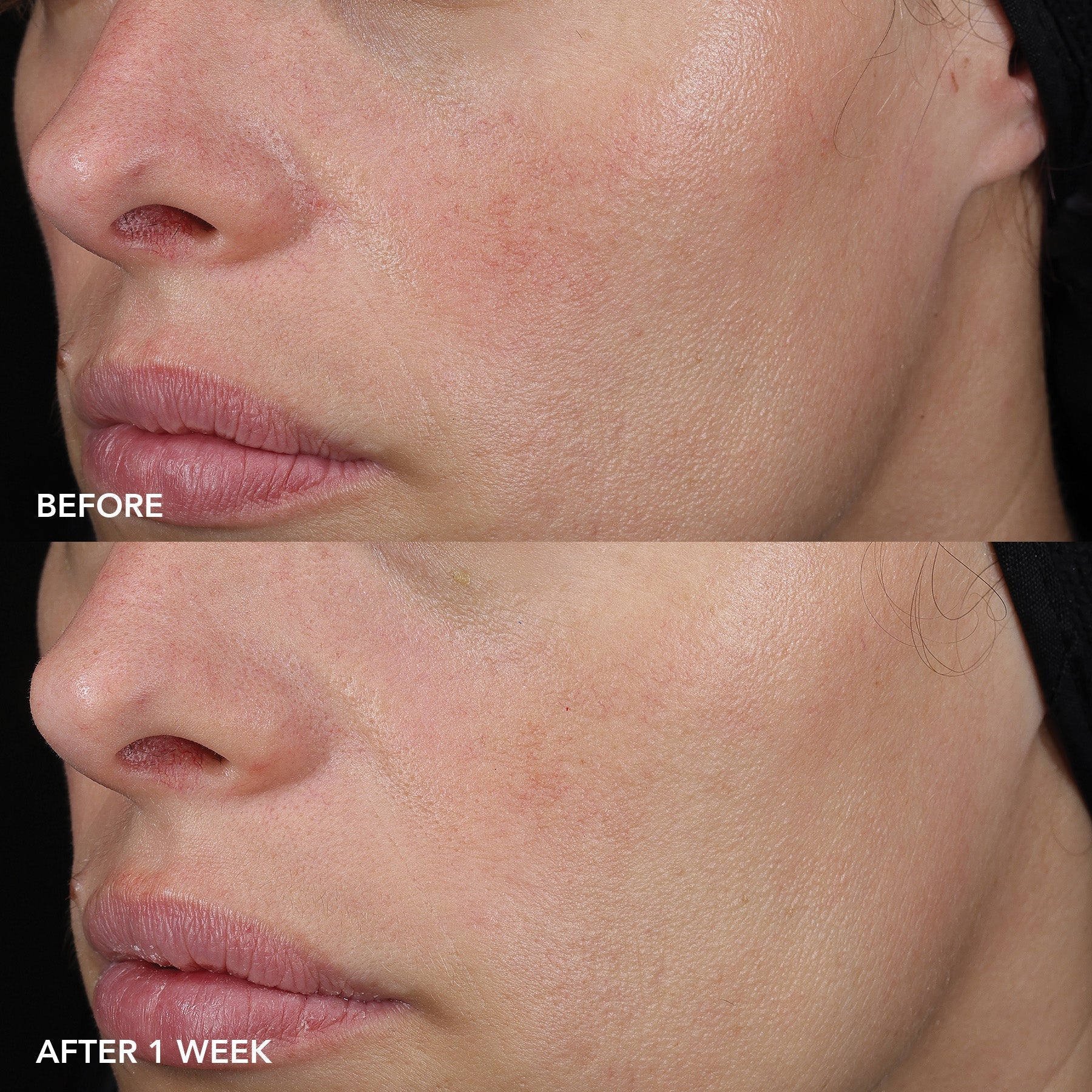 IMAGE MD® Barrier Repair Recovery Balm