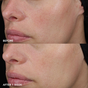 IMAGE MD® Barrier Repair Recovery Balm