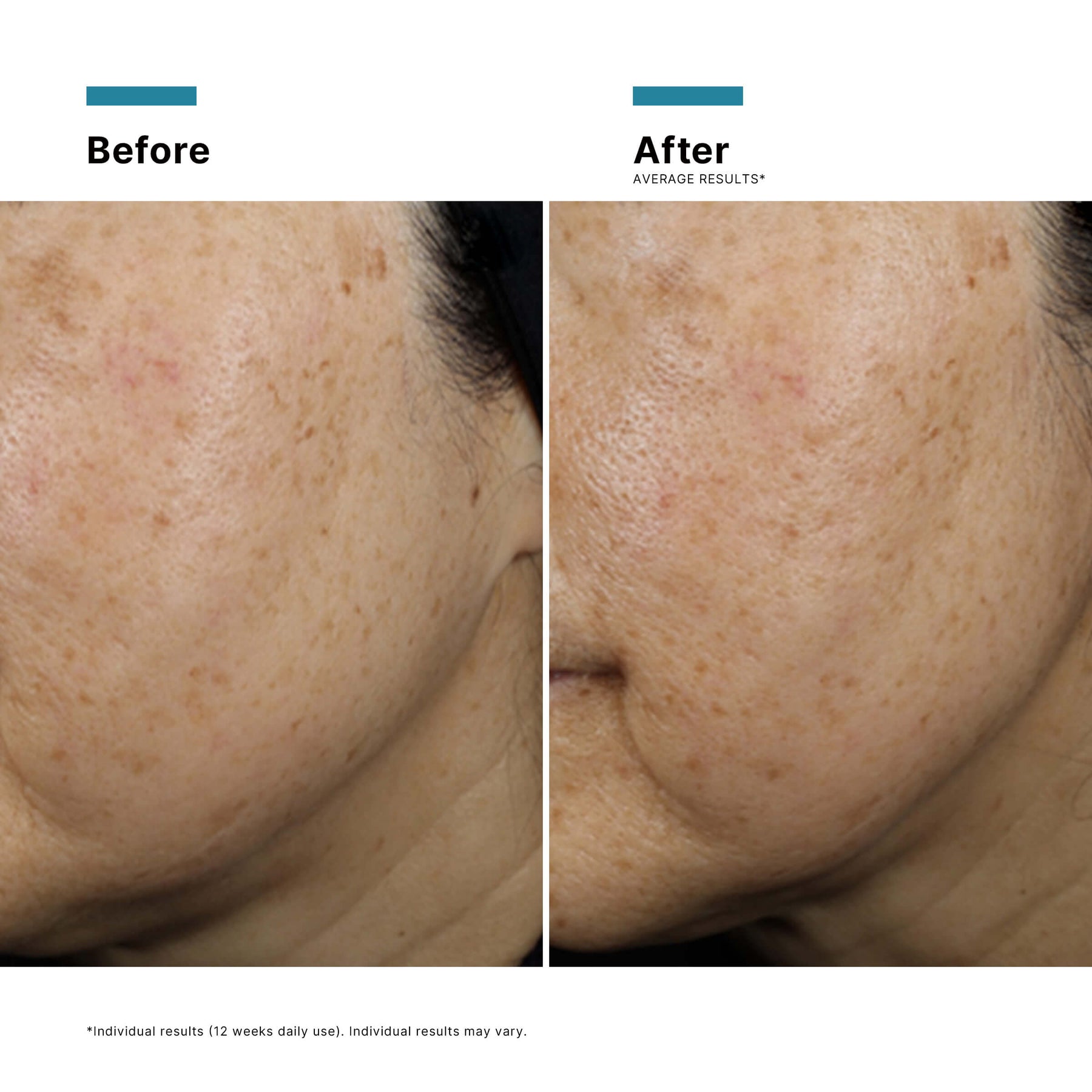 SkinCeuticals A.G.E. Defying Gift Set