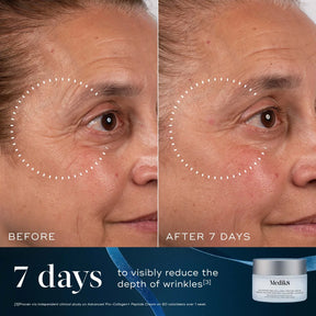 Medik8 Age-Defying Essentials Kit