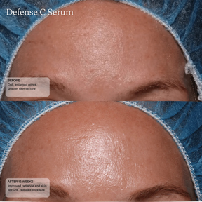 Sente Defense C Serum 30 ml