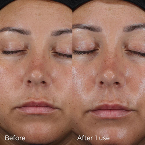 IMAGE DAILY PREVENTION Ultra Defense Moisturiser SPF 50