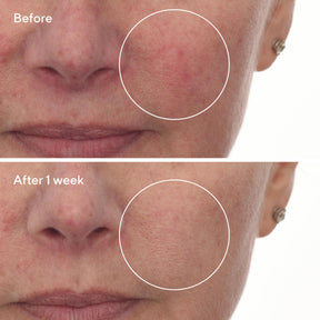 Murad Cellular Hydration Barrier Repair Serum
