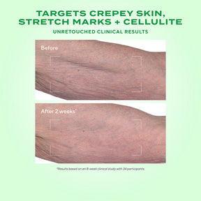 Murad Retinal ReSculpt Body Treatment