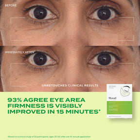 Murad Retinol Youth Renewal Eye Mask