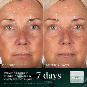 Medik8 Nighttime Nourish Kit
