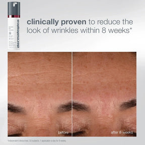 Dermalogica Ultimate Expertise Kit (6 Full-Sizes + 3 Skincare Tools)