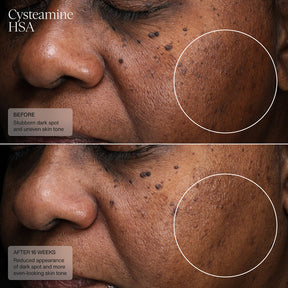 Sente Pigment & Tone Correcting Mask, Cysteamine + HSA