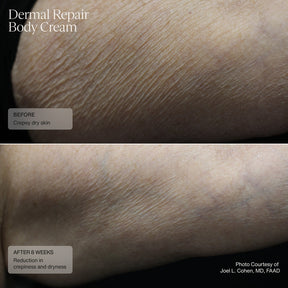 Sente Dermal Repair Body Cream