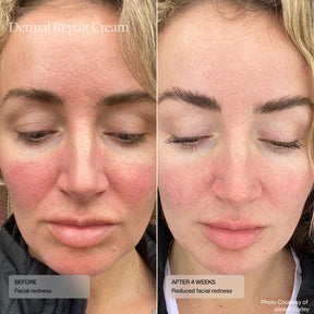 Sente Dermal Repair Cream 50 ml