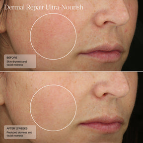 Sente Dermal Repair Ultra-Nourish
