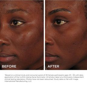 Image ILUMA Intense Facial illuminator 30ml