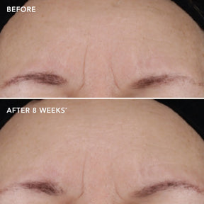 Image Skincare AGELESS+ Treatment Crème 1.2% Retinol Complex 28.5g