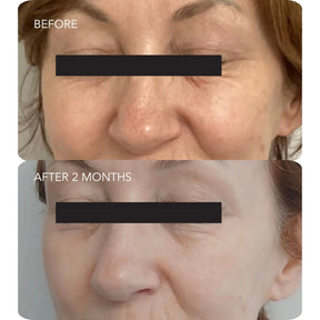 Image Skincare VOL.U.LIFT™ 4D Skin Rebound Complex