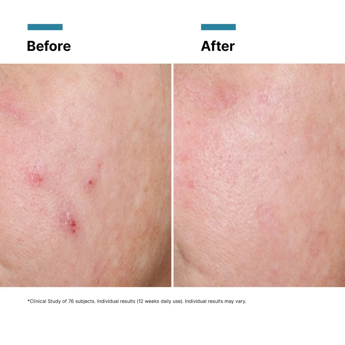 SkinCeuticals Advanced RGN-6 Regenerative Cream 50ml