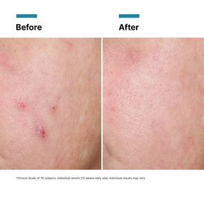 SkinCeuticals Advanced RGN-6 Regenerative Cream 50ml