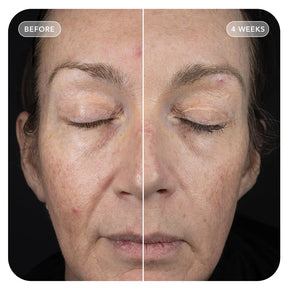 Image Skincare VOL.U.LIFT™ 4D Skin Rebound Complex