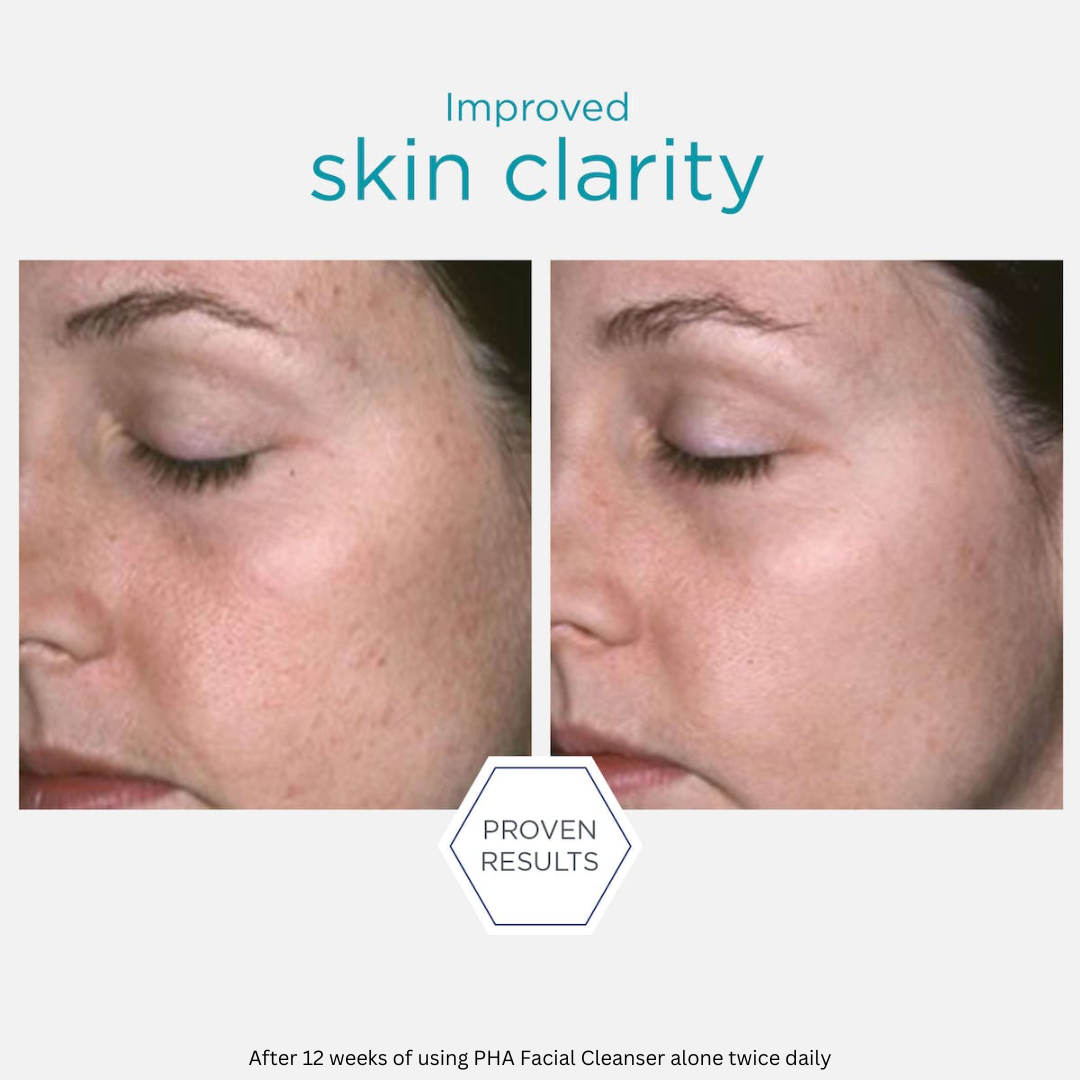 Neostrata facial cleanser deals