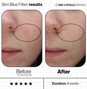 Advanced Nutrition Programme Skin Blue Filter (60 Capsules)