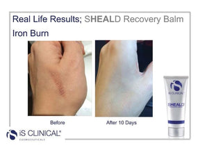 iS Clinical SHEALD Recovery Balm 60g